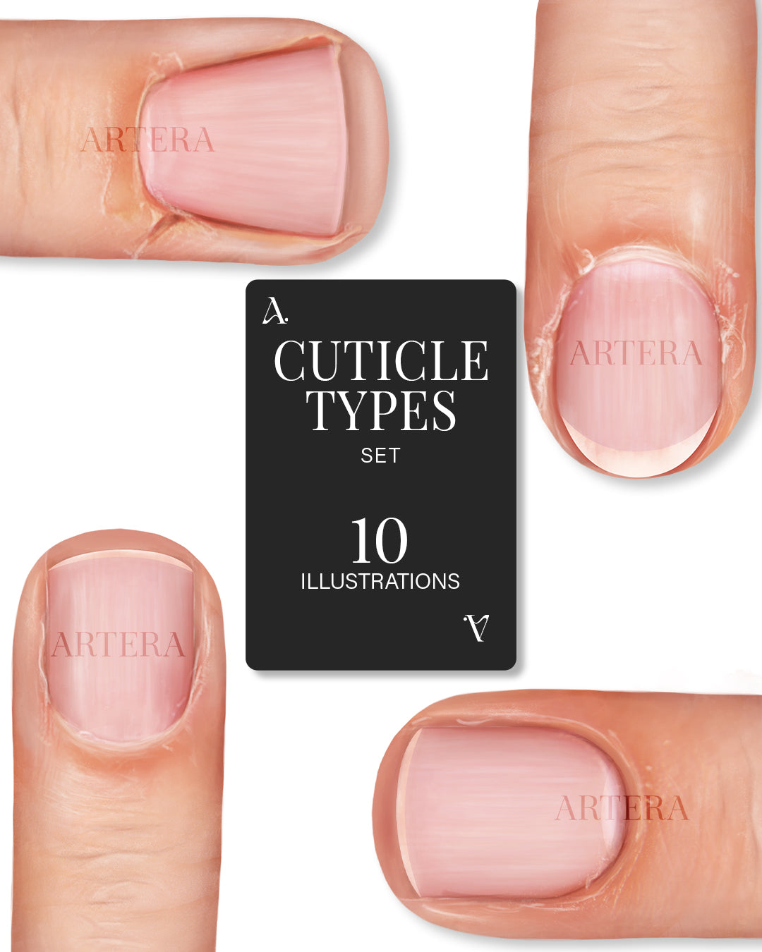 Cuticle Types - Set of 10 Illustrations