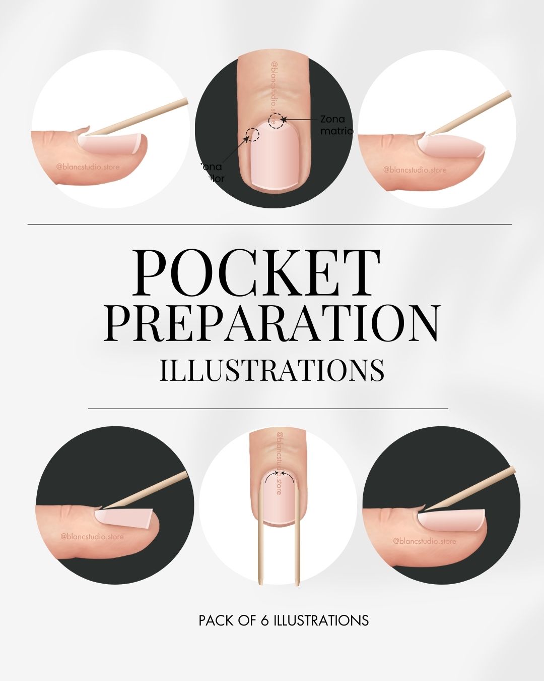 Pocket preparation - 6 Advanced Illustrations